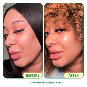 Customer-submitted results photo